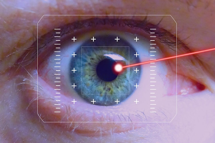 FEMTO-Lasik